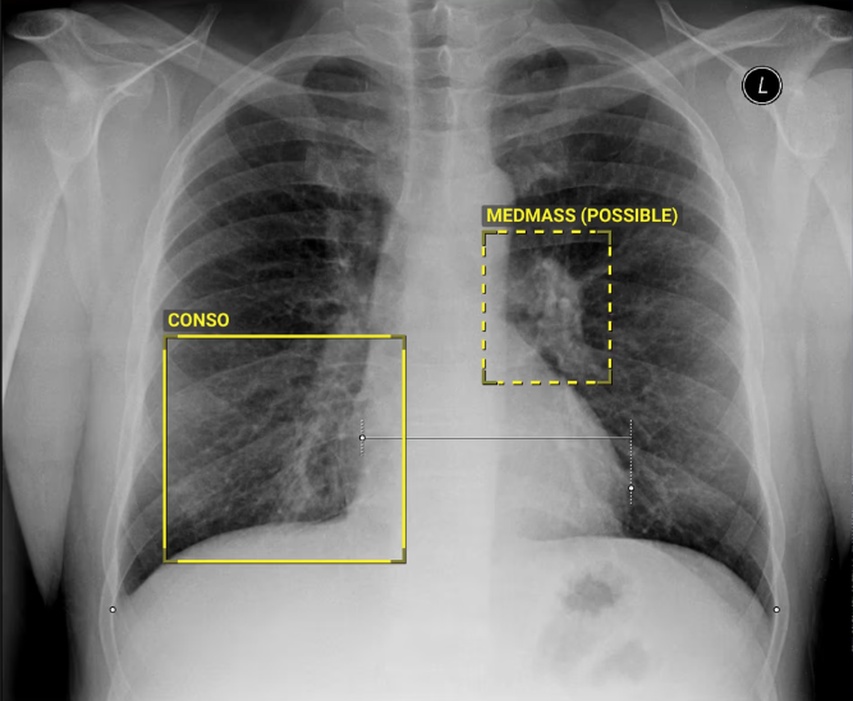 Radiografie adnotată de AI